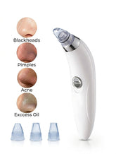 Blackhead Vacuum Remover, Powerful Portable Facial Pore Cleaner With 4 Probes, Remove Blackhead In Gentle And Way Without Squeezing Pain For Women And Men. Your Personal Professional Beautician.